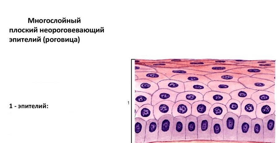 Решение рисунок 1